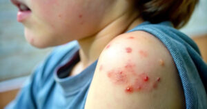 La presidencia vive en el ojo del huracán a causa de lo que dejó de hacer su antecesor y lo que hizo mal